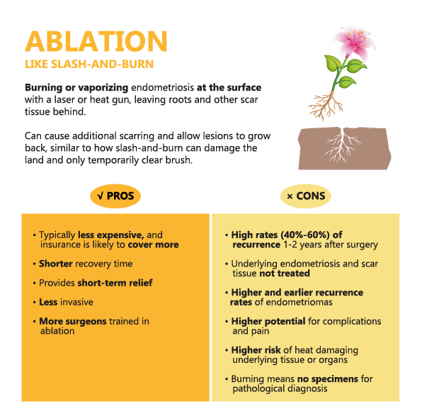 ablation