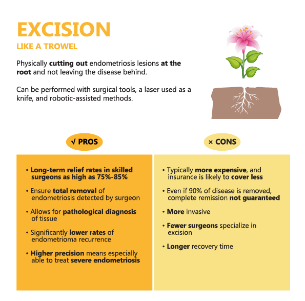 excision